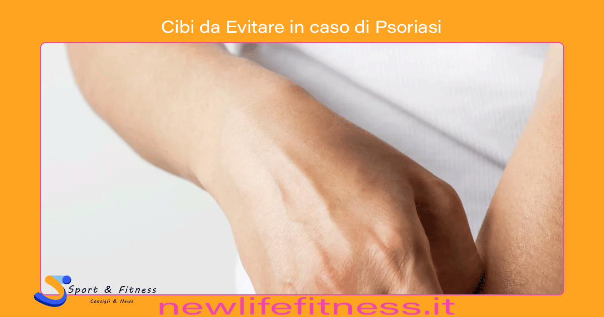 Cibi da Evitare in caso di Psoriasi